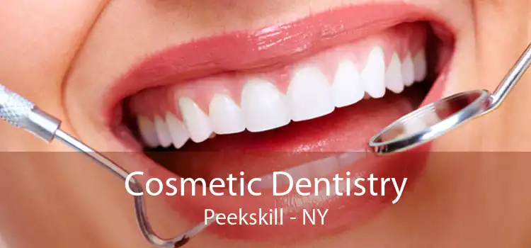 Cosmetic Dentistry Peekskill - NY