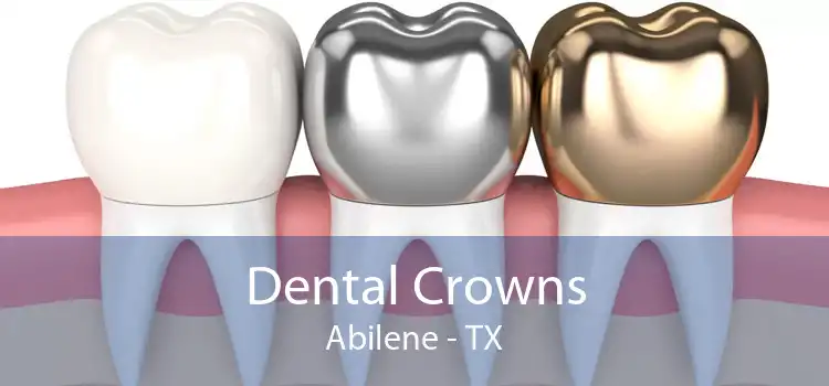 Dental Crowns Abilene - TX