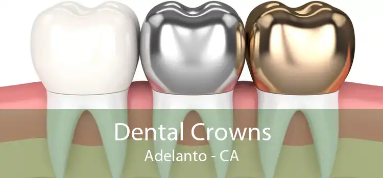 Dental Crowns Adelanto - CA