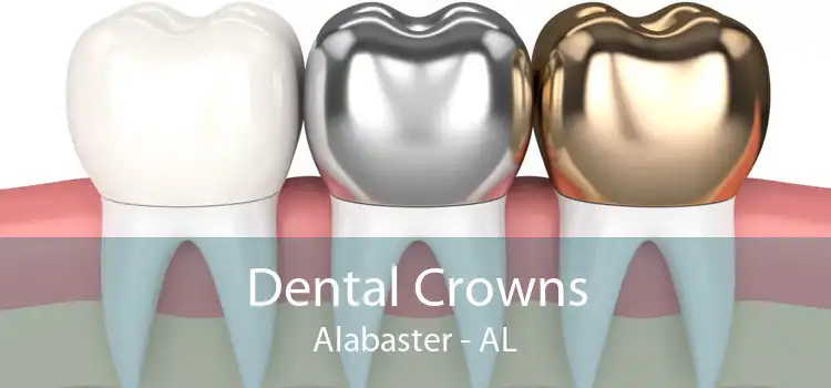 Dental Crowns Alabaster - AL