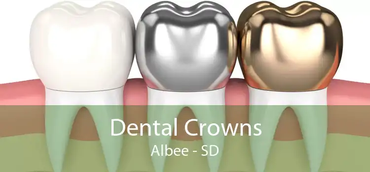 Dental Crowns Albee - SD