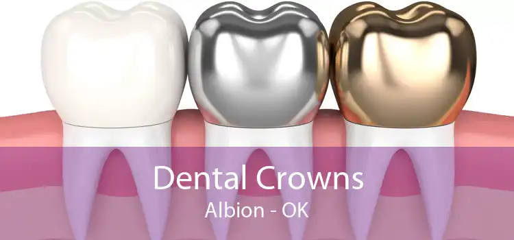 Dental Crowns Albion - OK