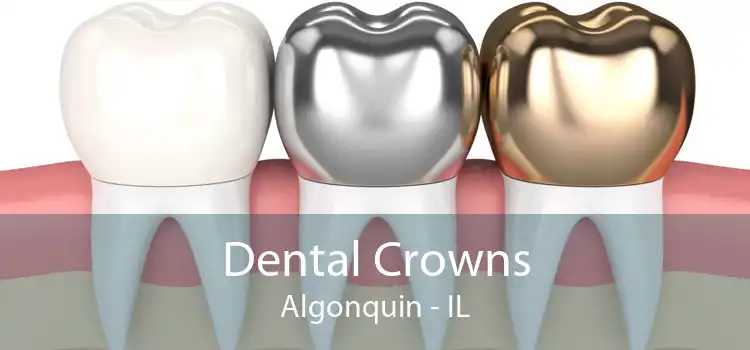 Dental Crowns Algonquin - IL