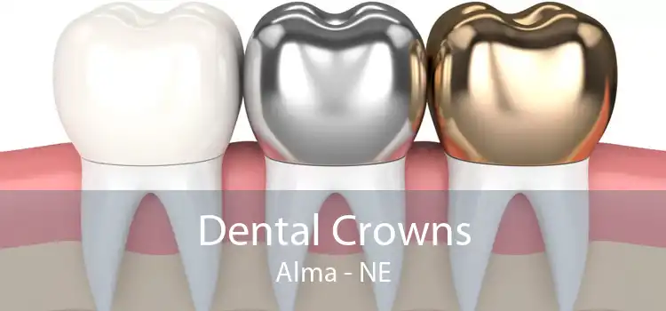 Dental Crowns Alma - NE