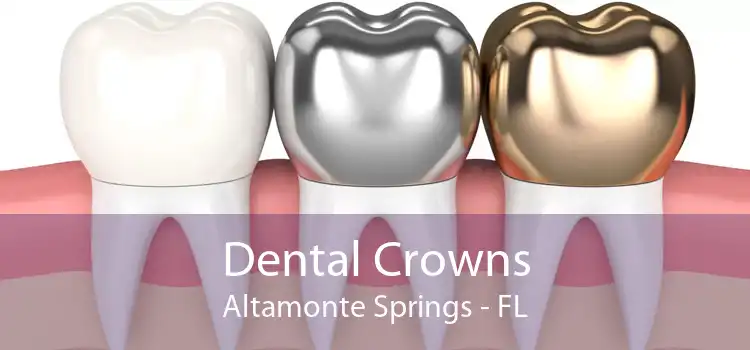 Dental Crowns Altamonte Springs - FL