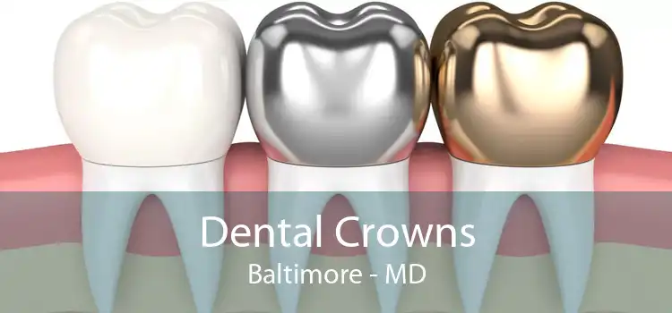 Dental Crowns Baltimore - MD