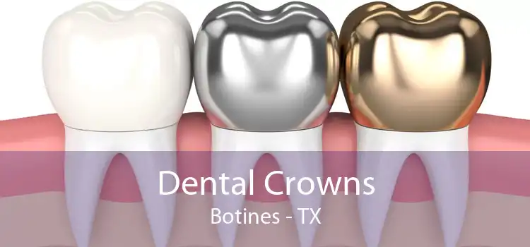 Dental Crowns Botines - TX