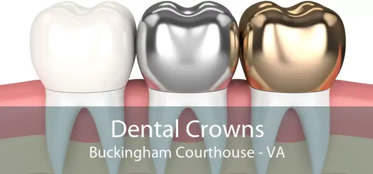 Dental Crowns Buckingham Courthouse - VA