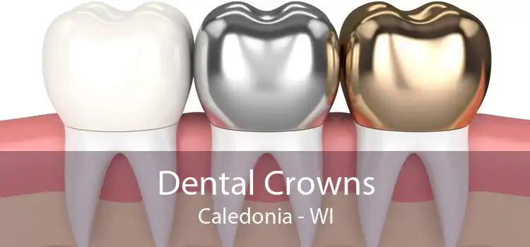 Dental Crowns Caledonia - WI