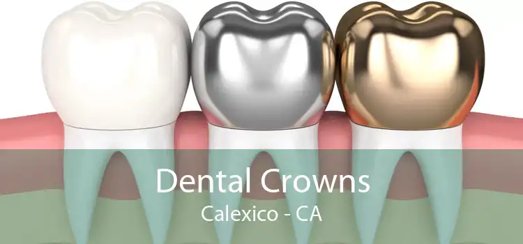 Dental Crowns Calexico - CA