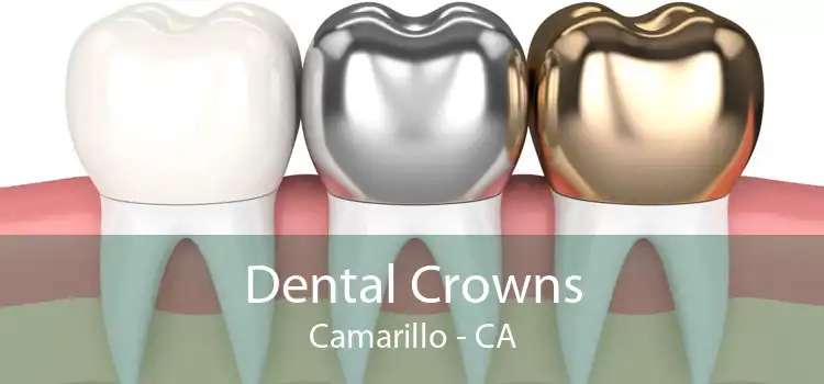 Dental Crowns Camarillo - CA