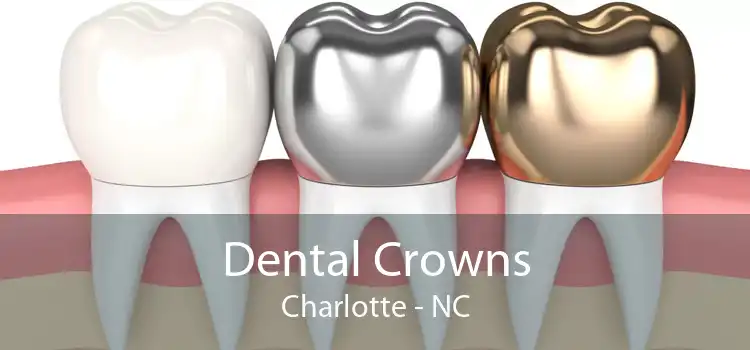 Dental Crowns Charlotte - NC