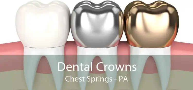 Dental Crowns Chest Springs - PA