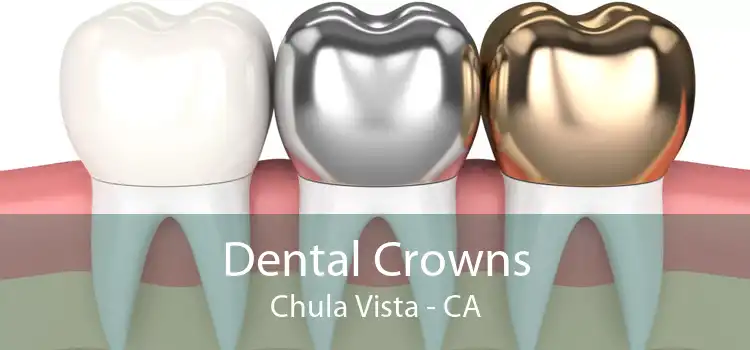 Dental Crowns Chula Vista - CA
