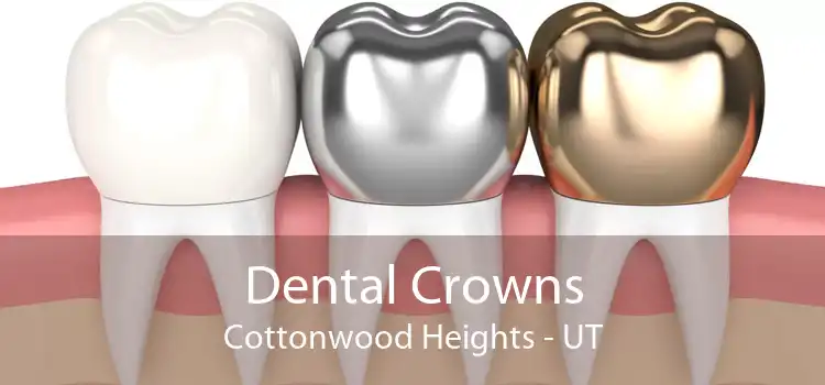 Dental Crowns Cottonwood Heights - UT