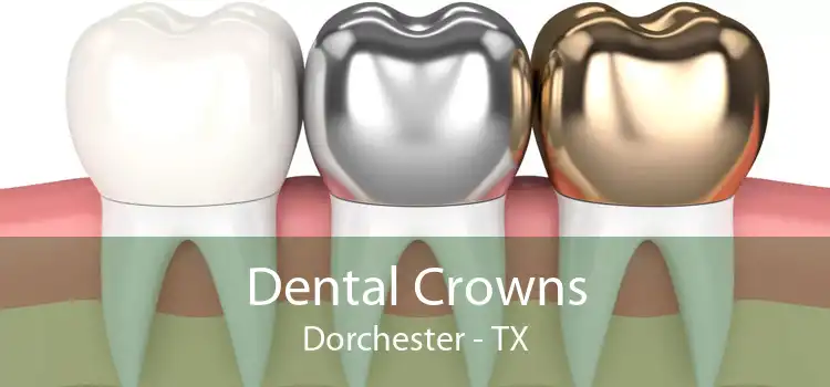 Dental Crowns Dorchester - TX