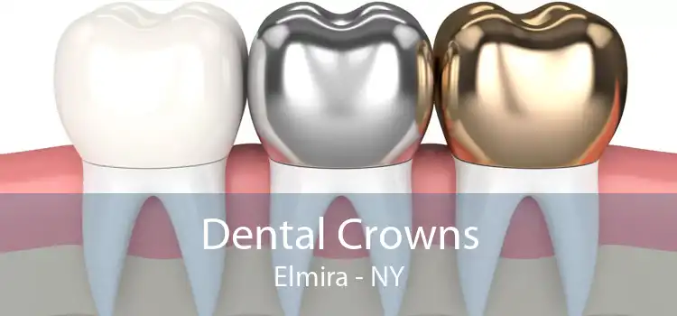 Dental Crowns Elmira - NY