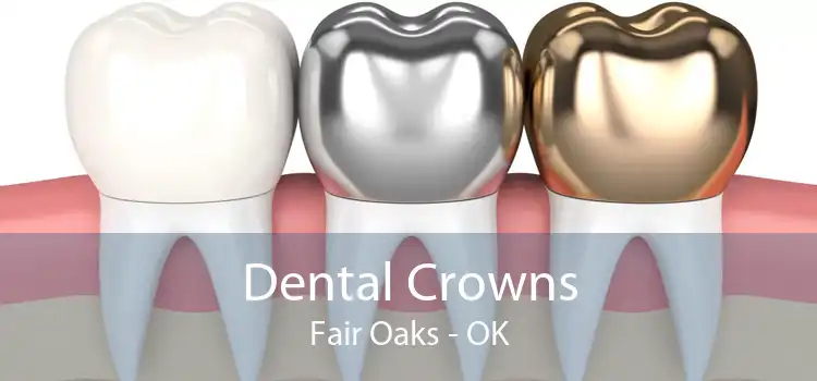 Dental Crowns Fair Oaks - OK