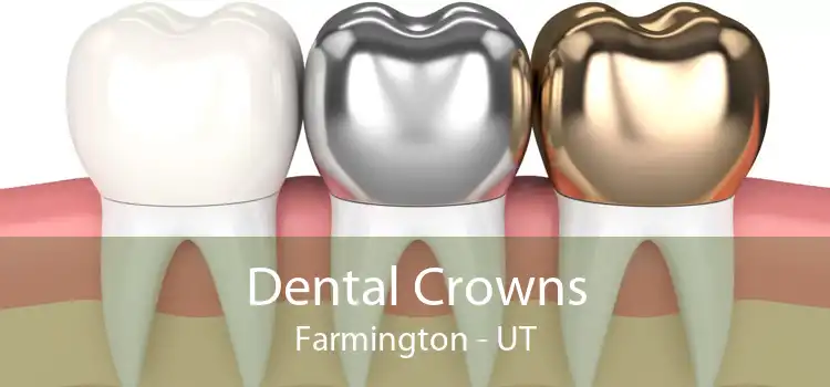 Dental Crowns Farmington - UT