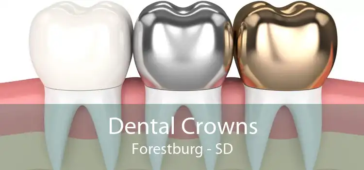 Dental Crowns Forestburg - SD