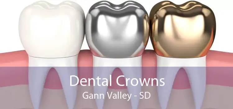 Dental Crowns Gann Valley - SD