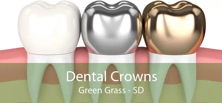 Dental Crowns Green Grass - SD