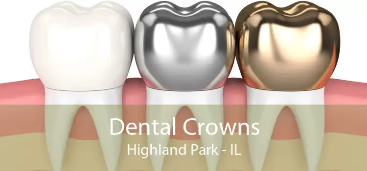 Dental Crowns Highland Park - IL