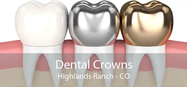 Dental Crowns Highlands Ranch - CO