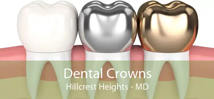 Dental Crowns Hillcrest Heights - MD