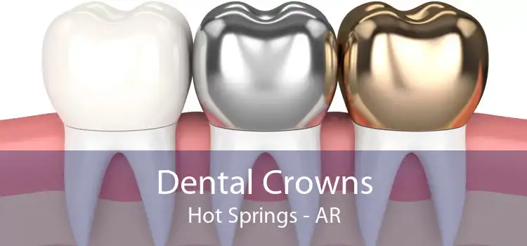 Dental Crowns Hot Springs - AR