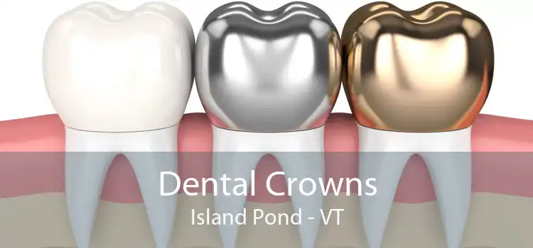 Dental Crowns Island Pond - VT