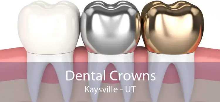 Dental Crowns Kaysville - UT