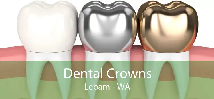 Dental Crowns Lebam - WA
