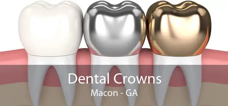 Dental Crowns Macon - GA