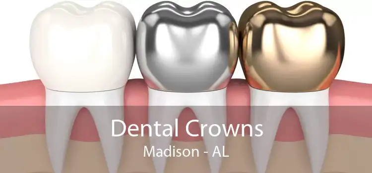 Dental Crowns Madison - AL