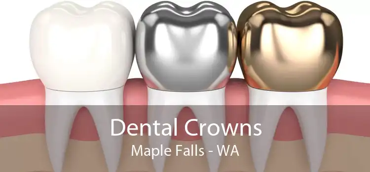 Dental Crowns Maple Falls - WA