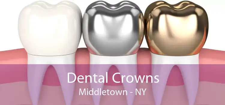 Dental Crowns Middletown - NY