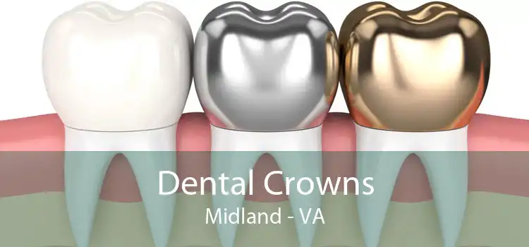 Dental Crowns Midland - VA