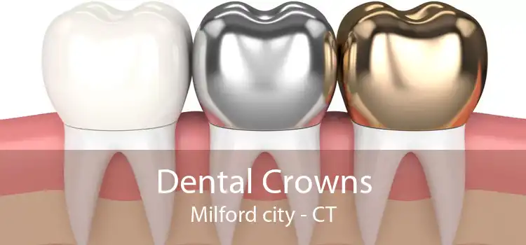 Dental Crowns Milford city - CT