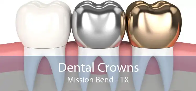 Dental Crowns Mission Bend - TX