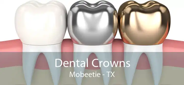 Dental Crowns Mobeetie - TX