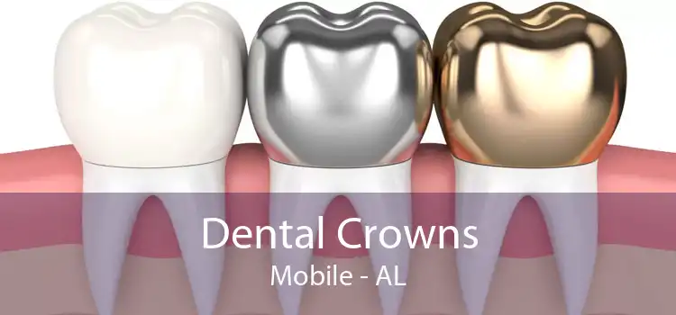 Dental Crowns Mobile - AL