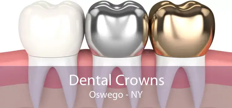 Dental Crowns Oswego - NY