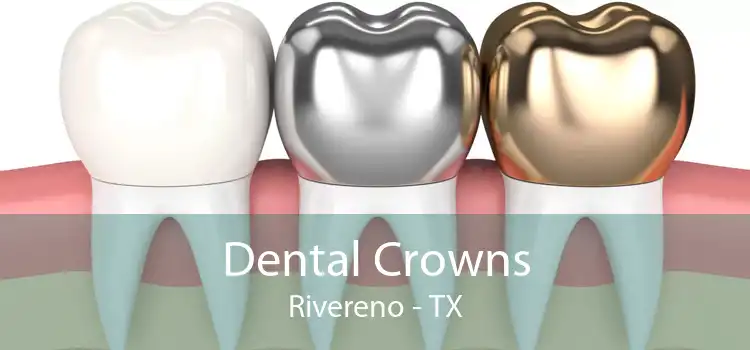 Dental Crowns Rivereno - TX
