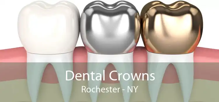 Dental Crowns Rochester - NY