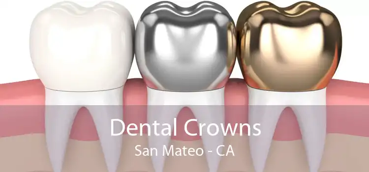 Dental Crowns San Mateo - CA