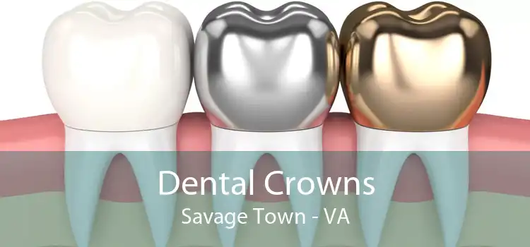 Dental Crowns Savage Town - VA