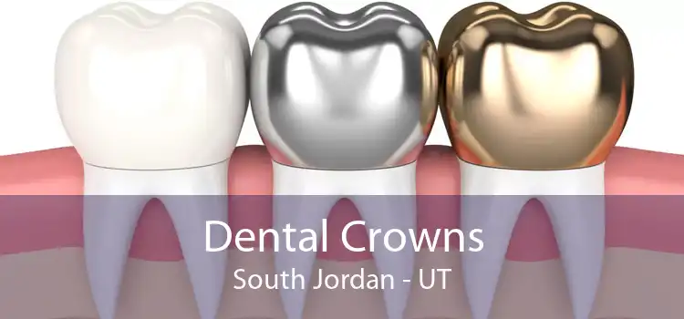 Dental Crowns South Jordan - UT