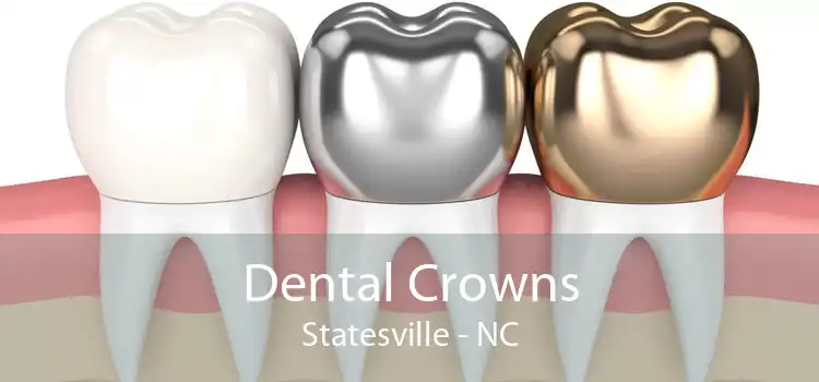 Dental Crowns Statesville - NC