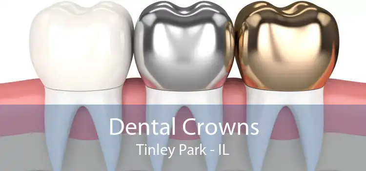 Dental Crowns Tinley Park - IL